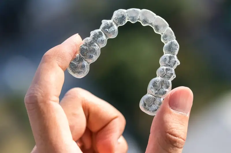 Ile kosztują nakładki Invisalign?