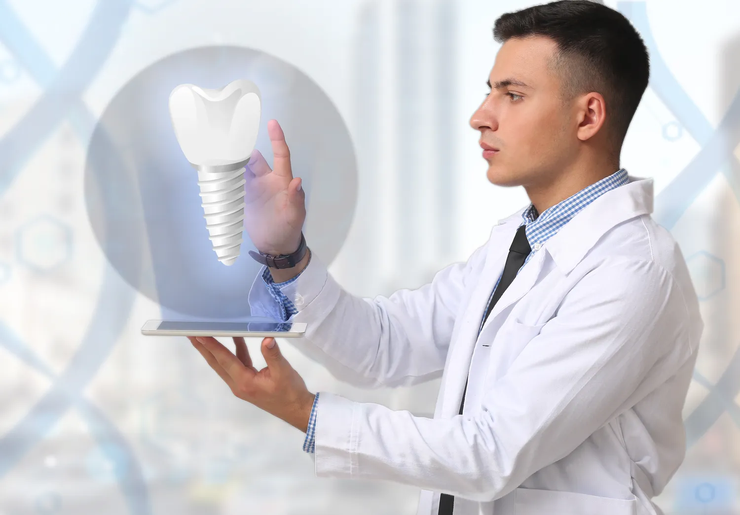 Rodzaje implantów zębowych