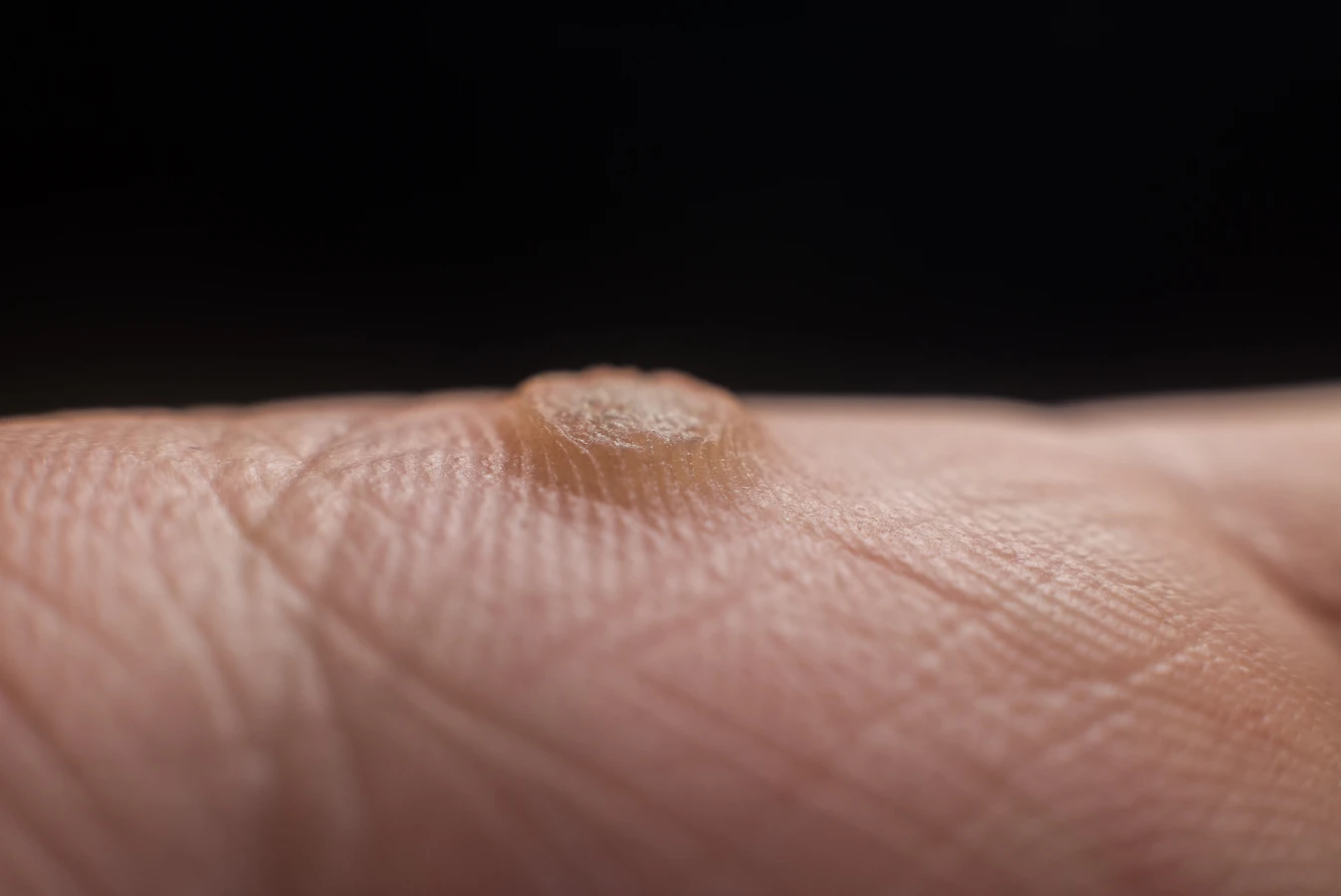 Czym jest pedicure leczniczy oraz na czym dokładnie polega?