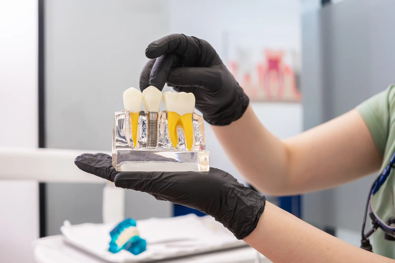 Implanty Lublin gdzie najlepiej?