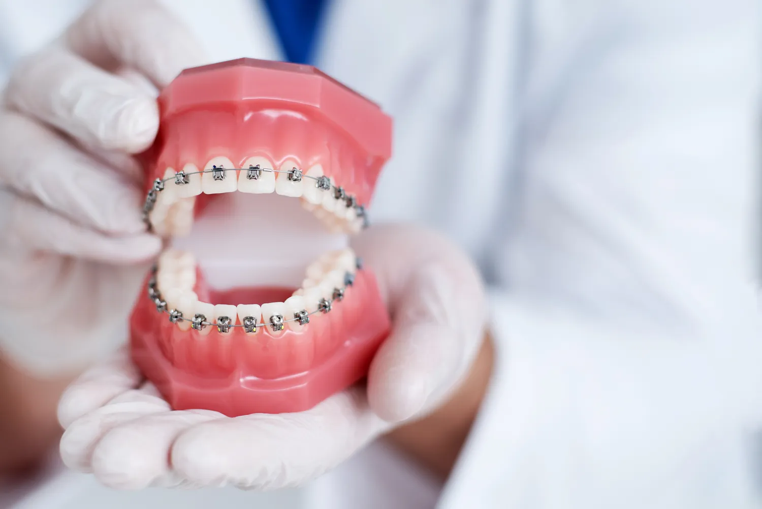 Jakie są rodzaje implantów zębowych?